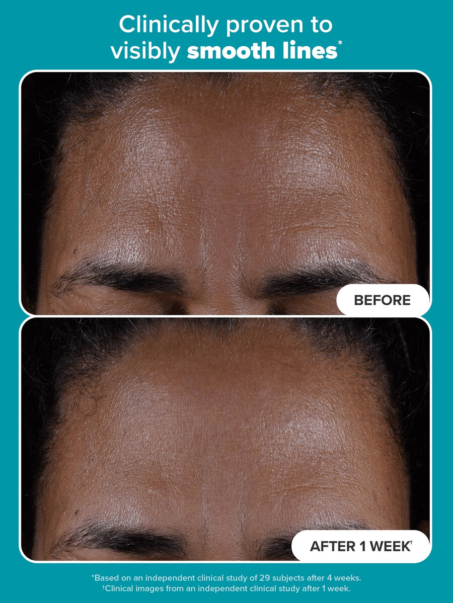 toallitas exfoliantes con 2 bha