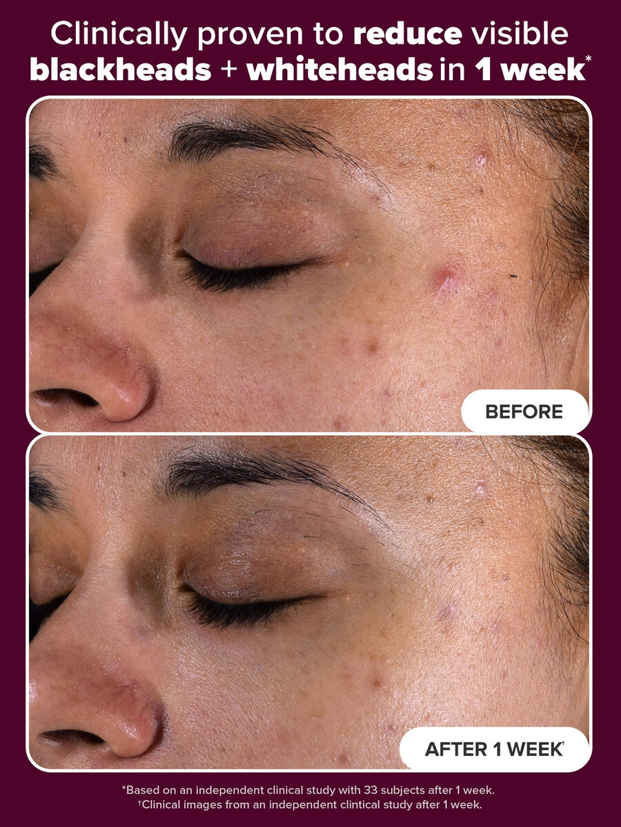 tónico exfoliante holiday edition 2 bha