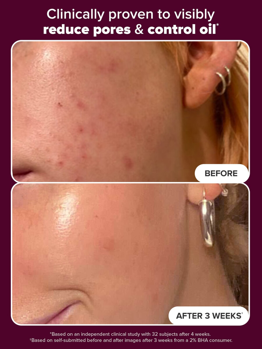 tónico exfoliante holiday edition 2 bha