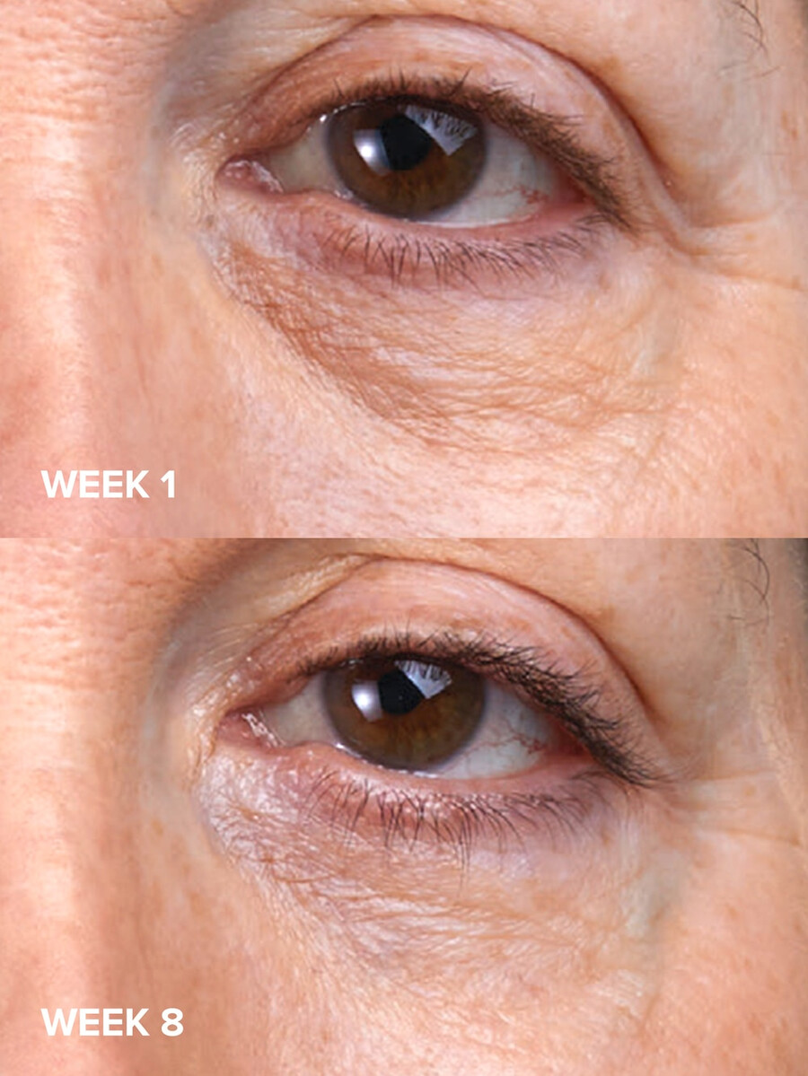 crema para ojos c5 super boost