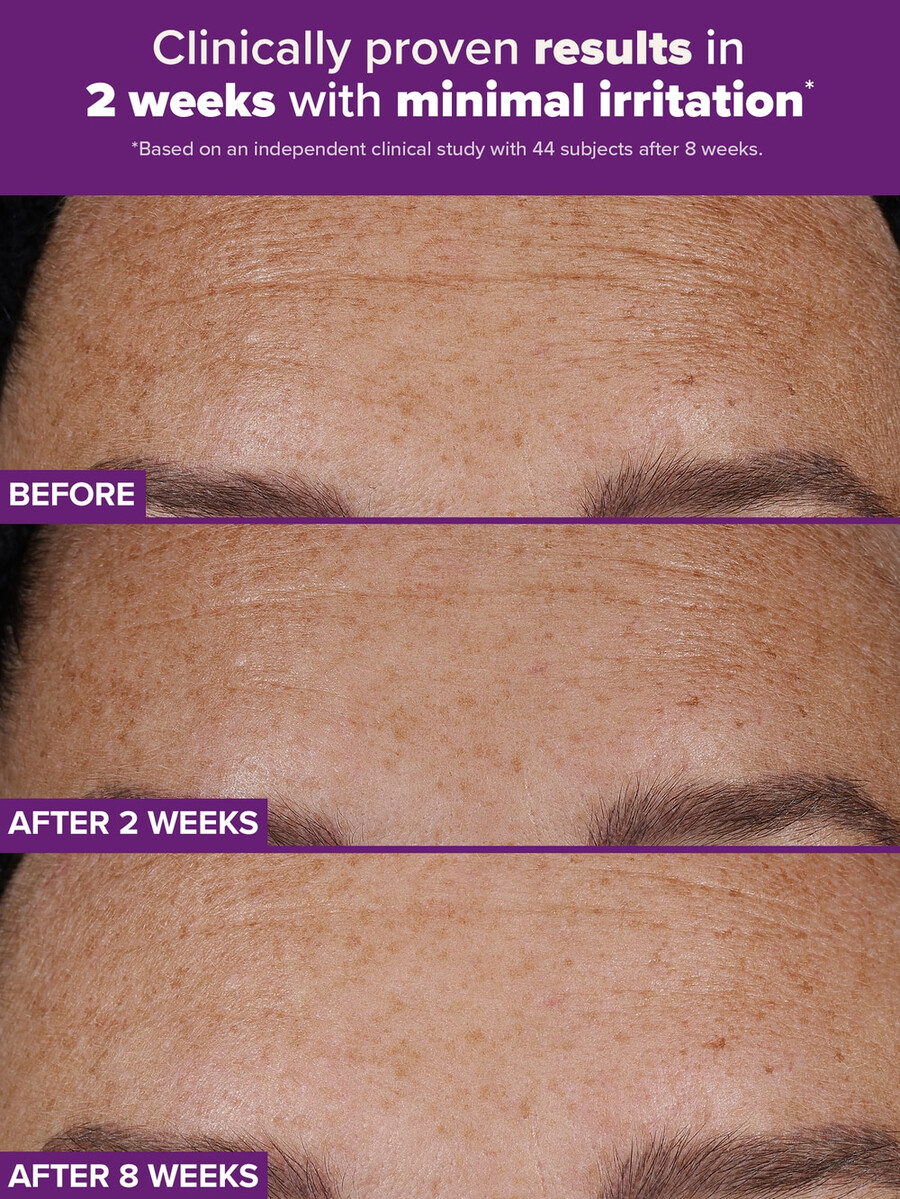 tratamiento dual con retinaldehído y retinoides clinical pro